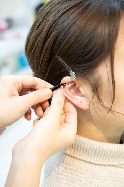 ⑥刺激があったり、目的に応じた耳つぼに、お客様に選んでいただいた耳つぼジュエリーシールを貼ります